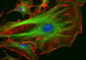 Image shows cells stained with ink. 