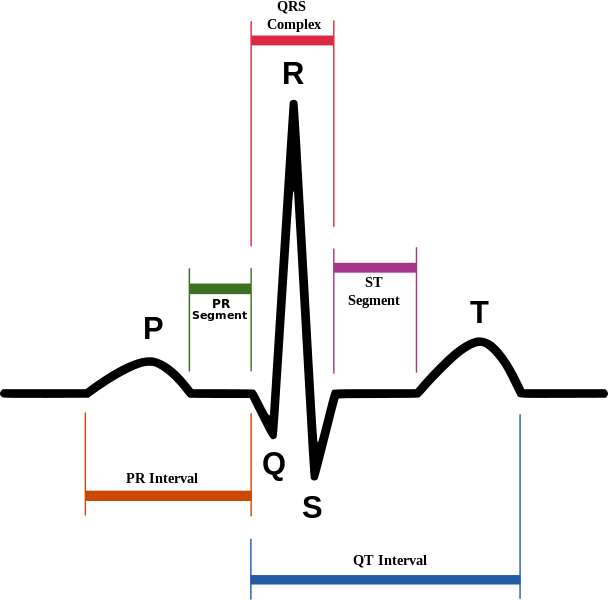 ECG-annotated