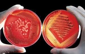 Image shows someone comparing two petri dishes.