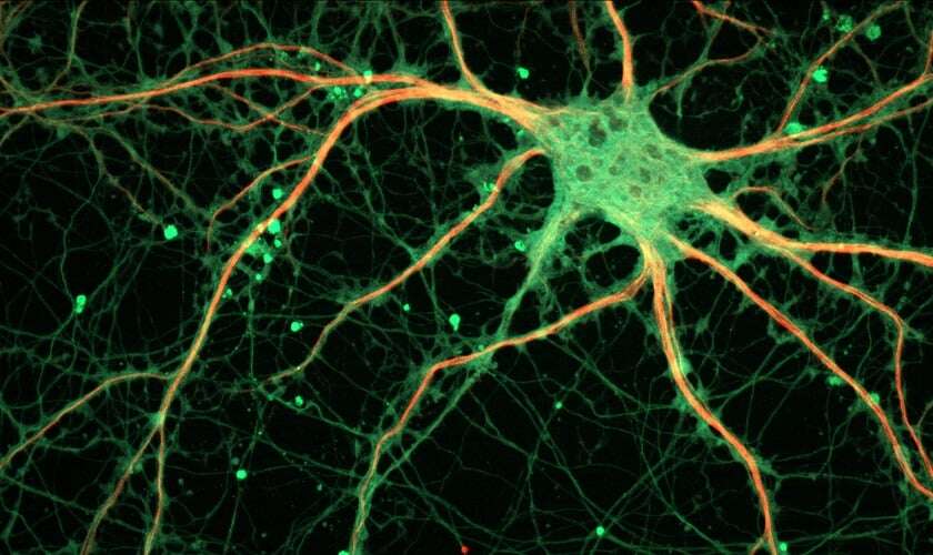 Image shows a neuron