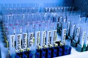 Image shows rows of test tubes for medical research.