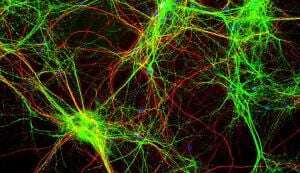 Image shows rat brain cells stained to show their different parts.